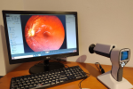 retinografia
