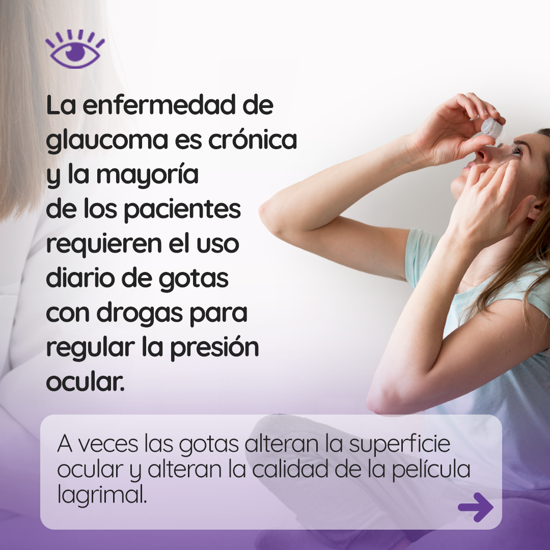 s2_glaucoma_feed_02