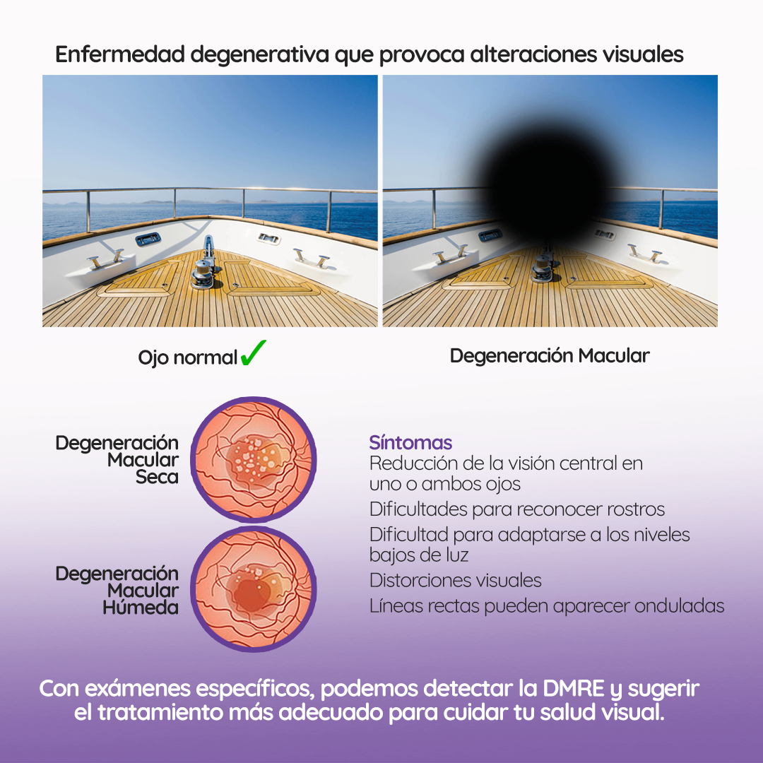 s3_degeneracionmacular_feed_03