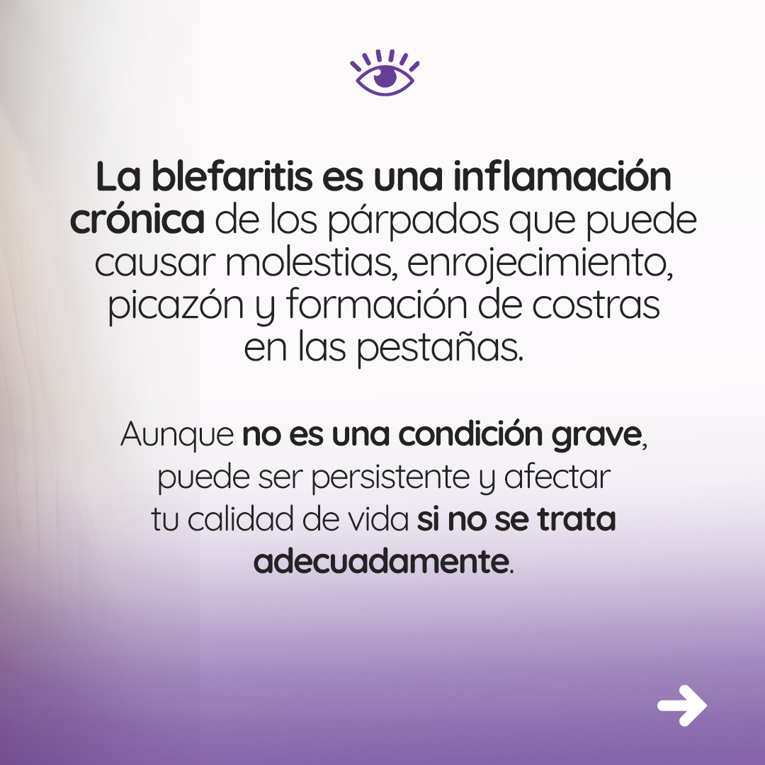 s4_blefaritis_feed_02