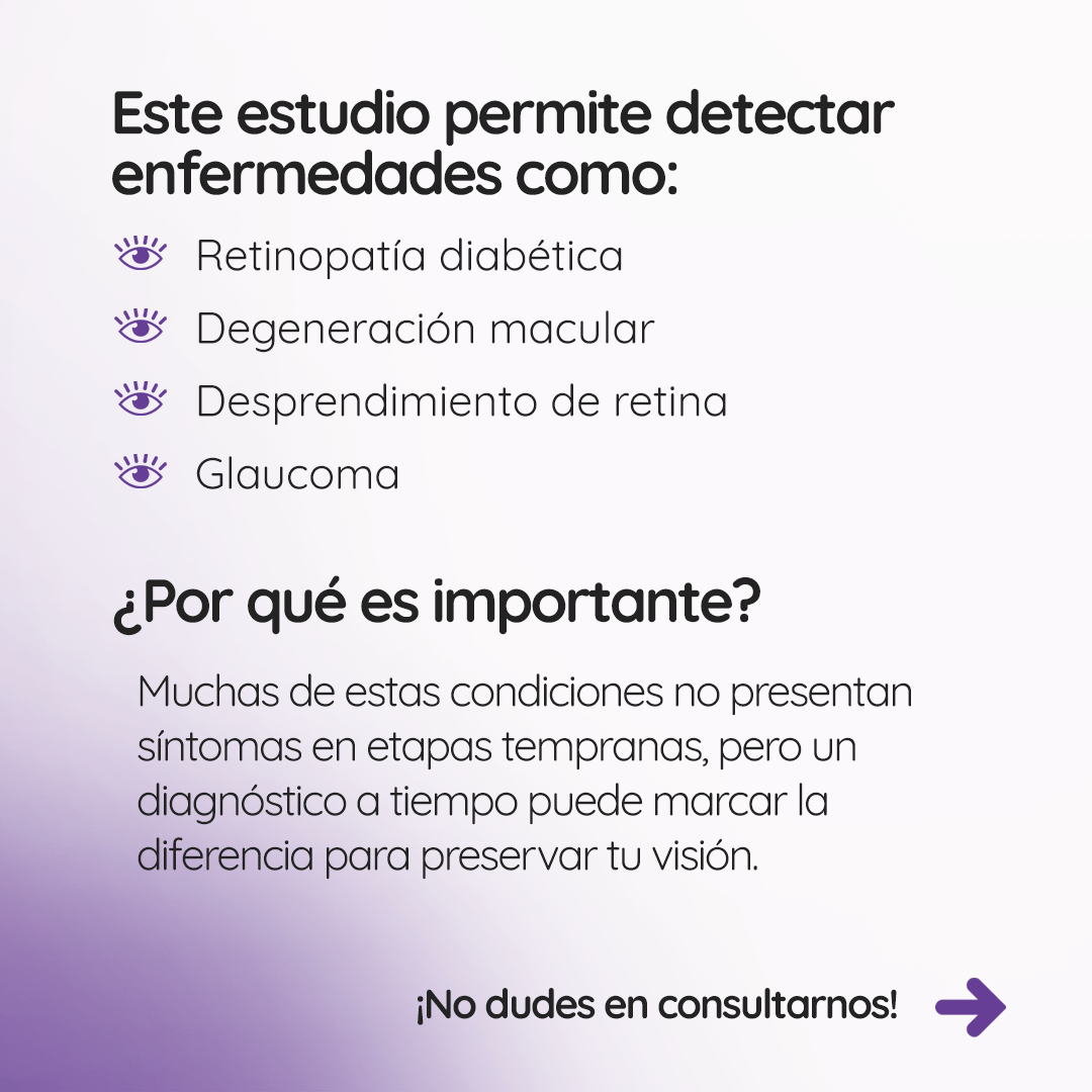 s2_fondodeojos_feed_02