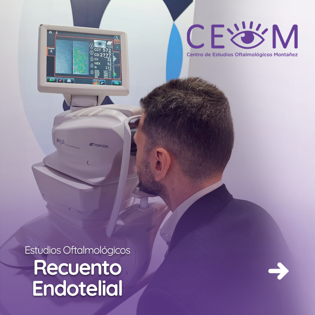 s2_recuentoendotelial_feed_01 s2_recuentoendotelial_feed_01
