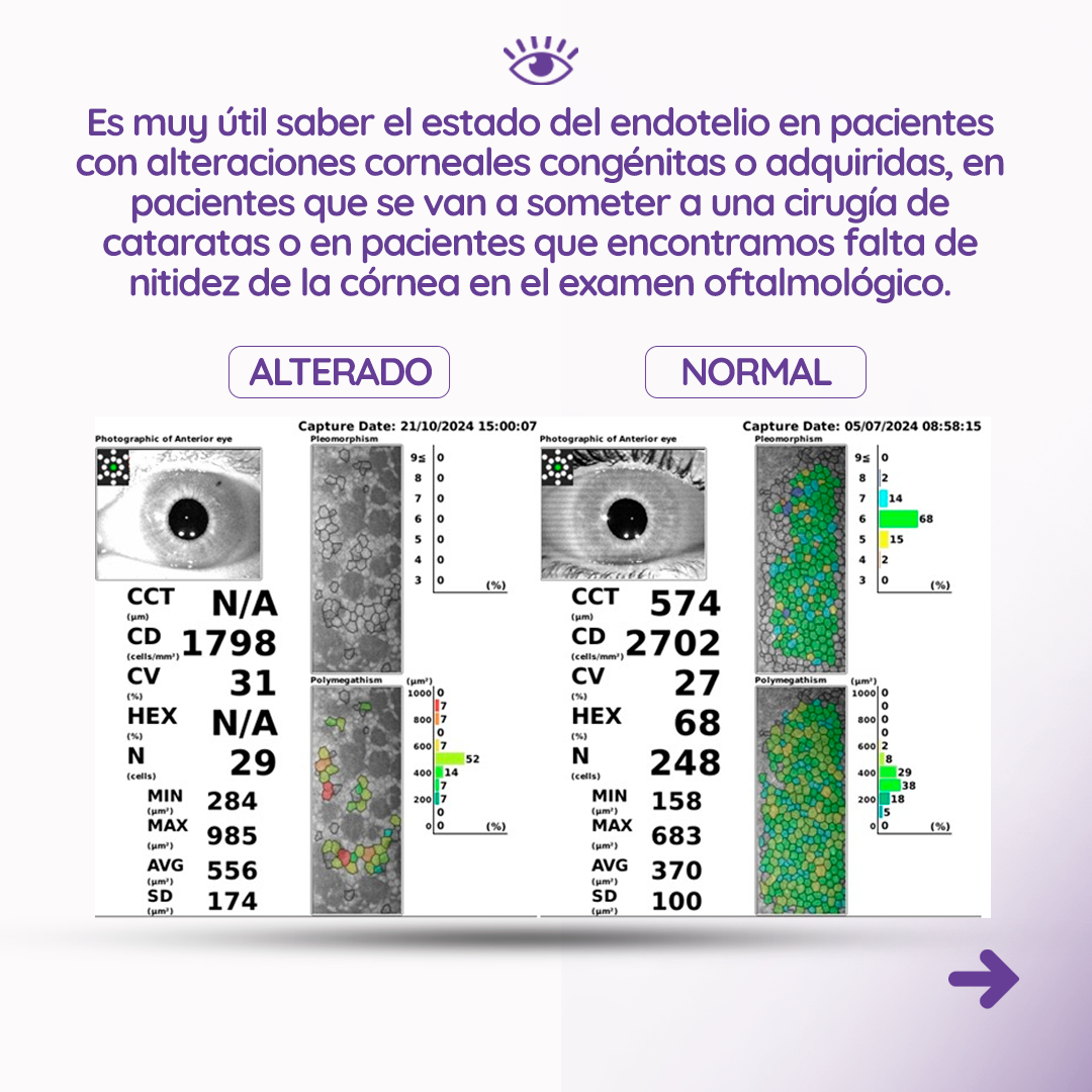s2_recuentoendotelial_feed_03 s2_recuentoendotelial_feed_03