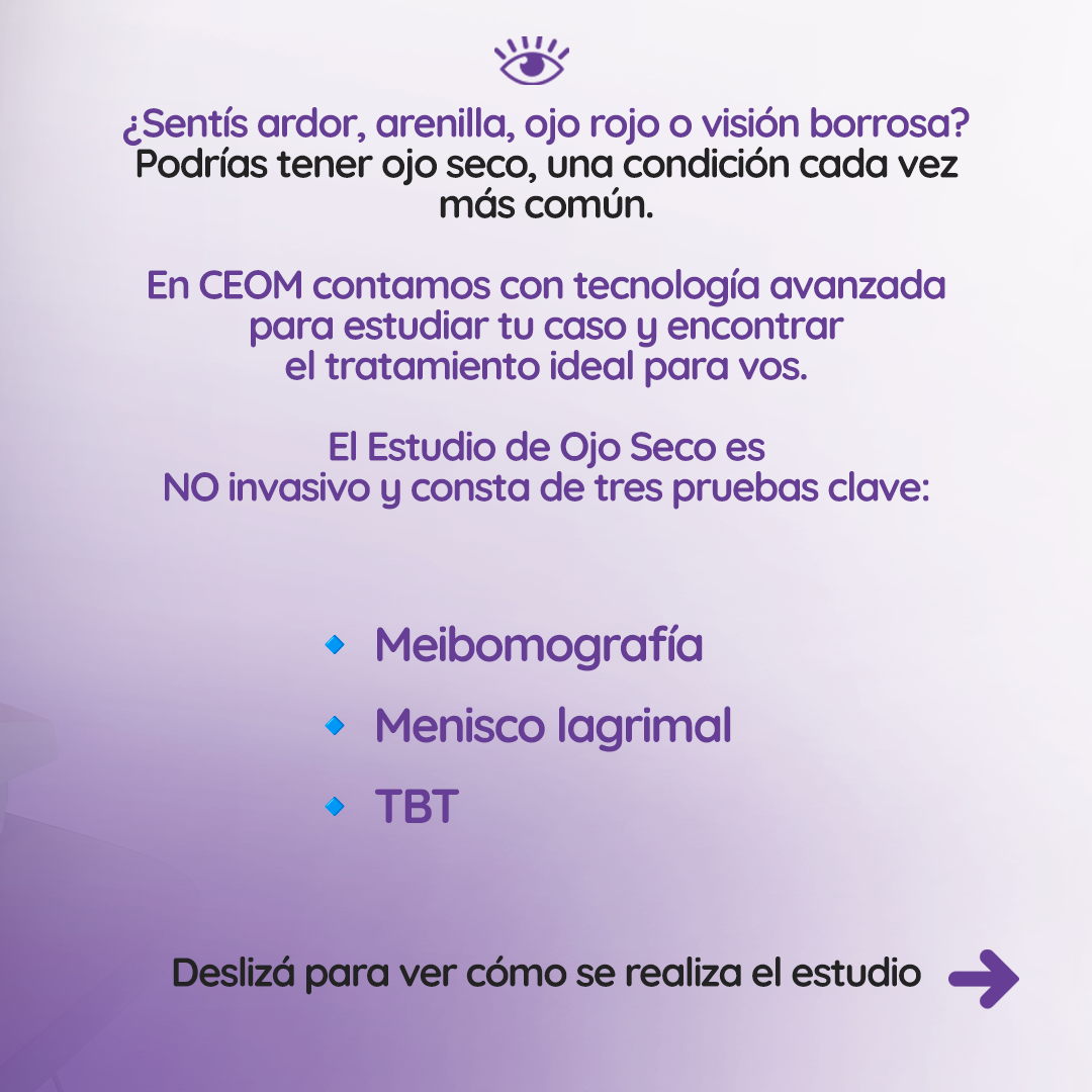 s3_ojoseco_feed_02