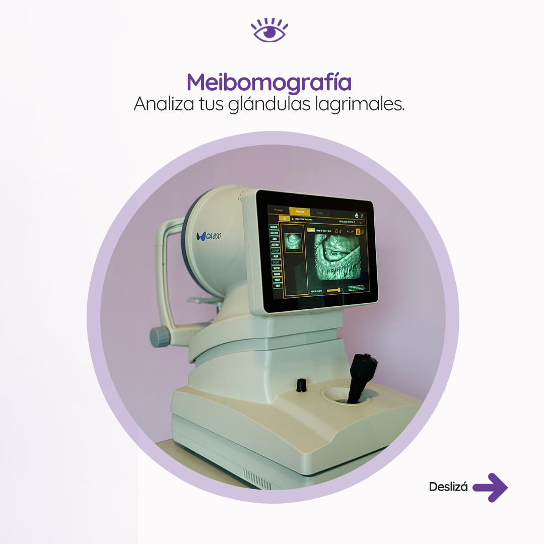 s3_ojoseco_feed_03