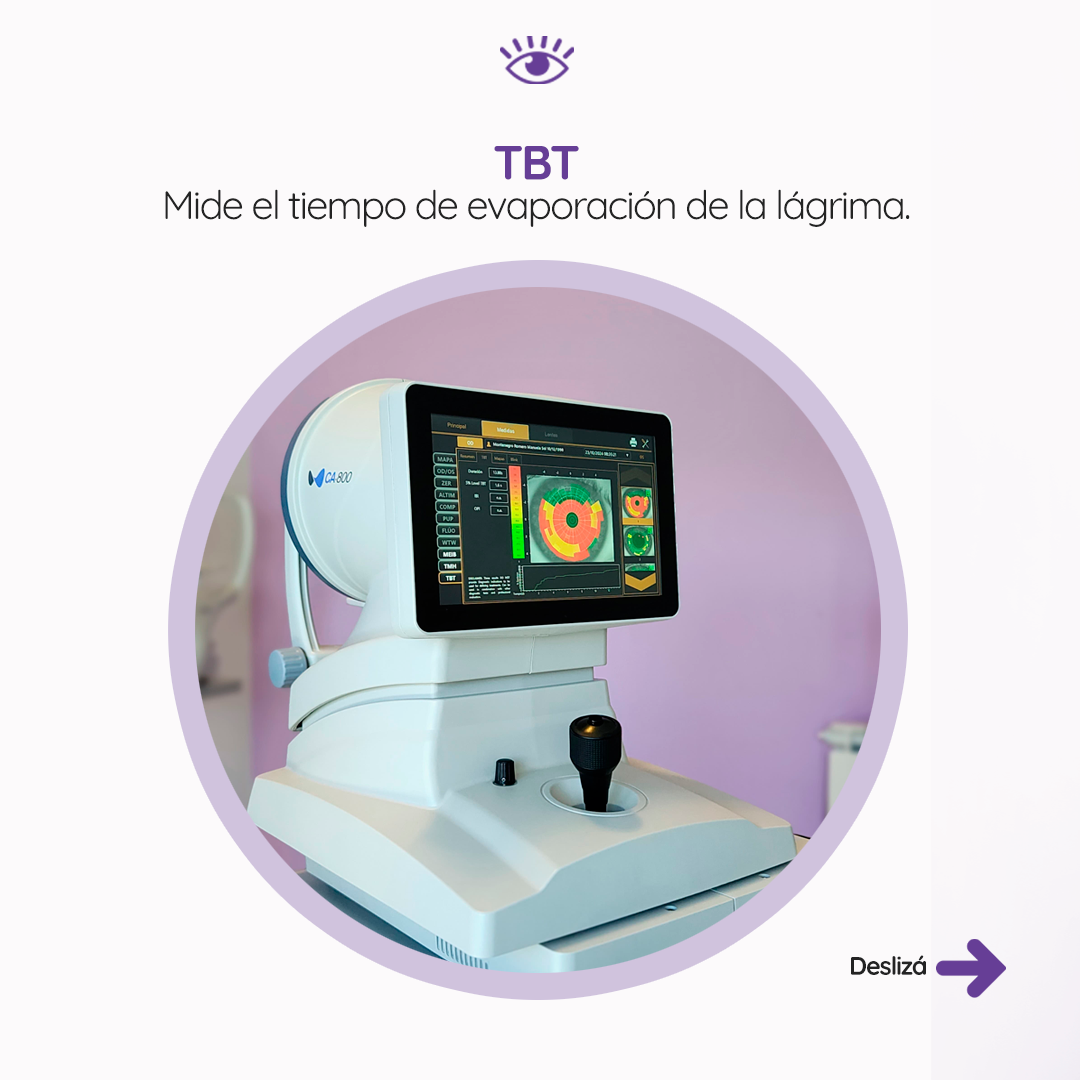 s3_ojoseco_feed_05