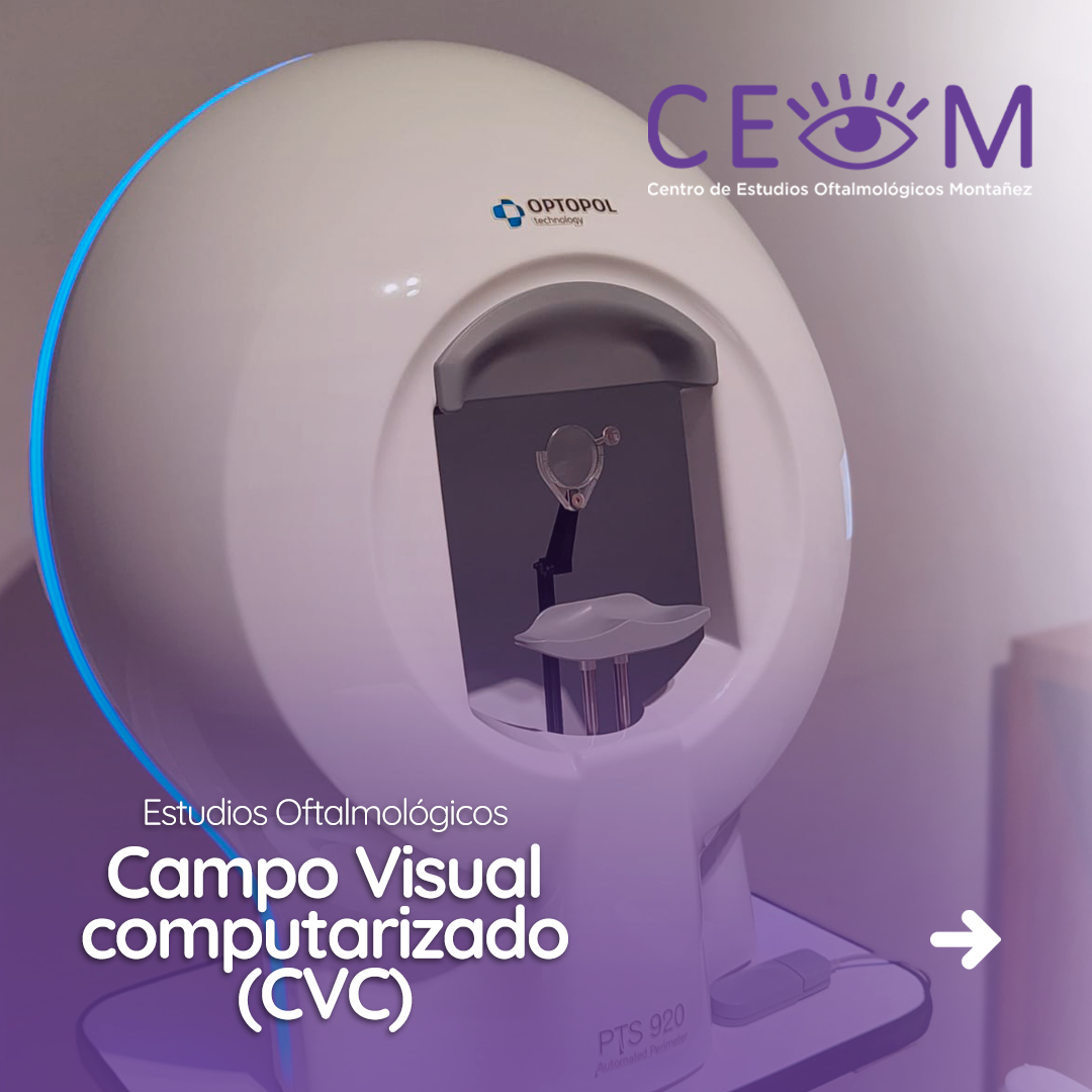s4_campovisualcomputarizadocvc_feed_01