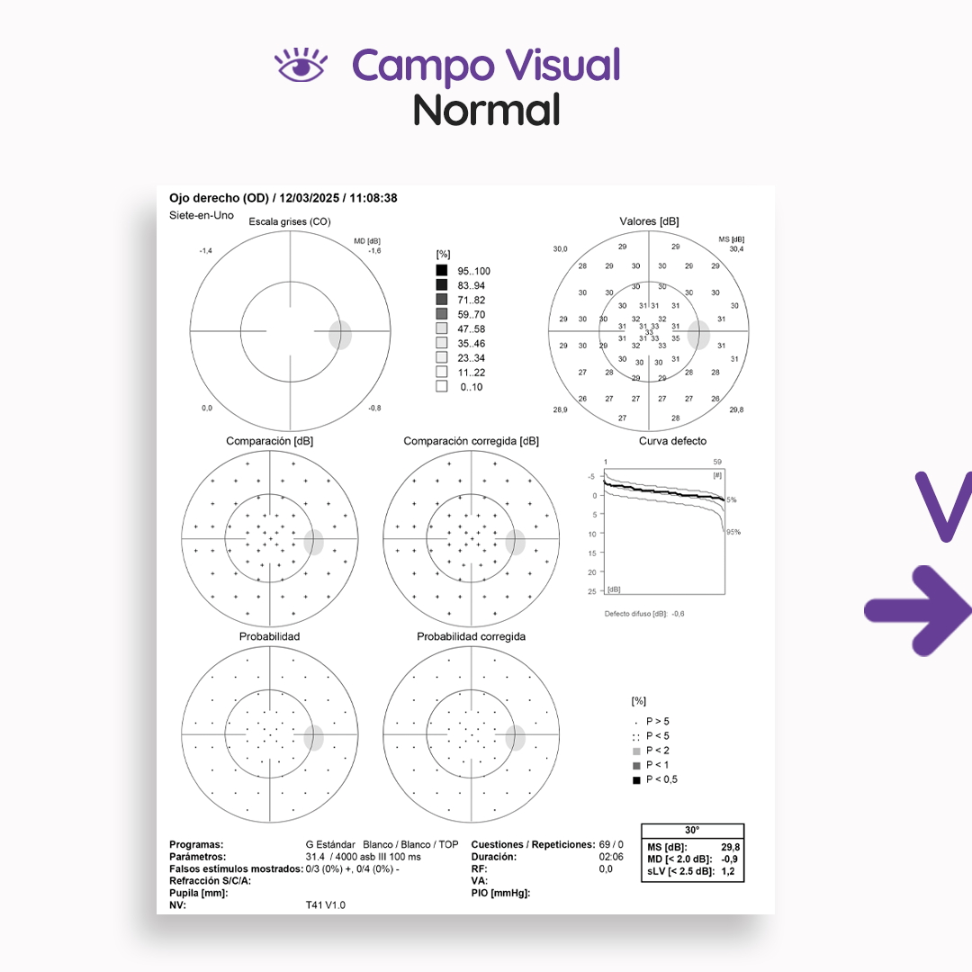 s4_campovisualcomputarizadocvc_feed_03