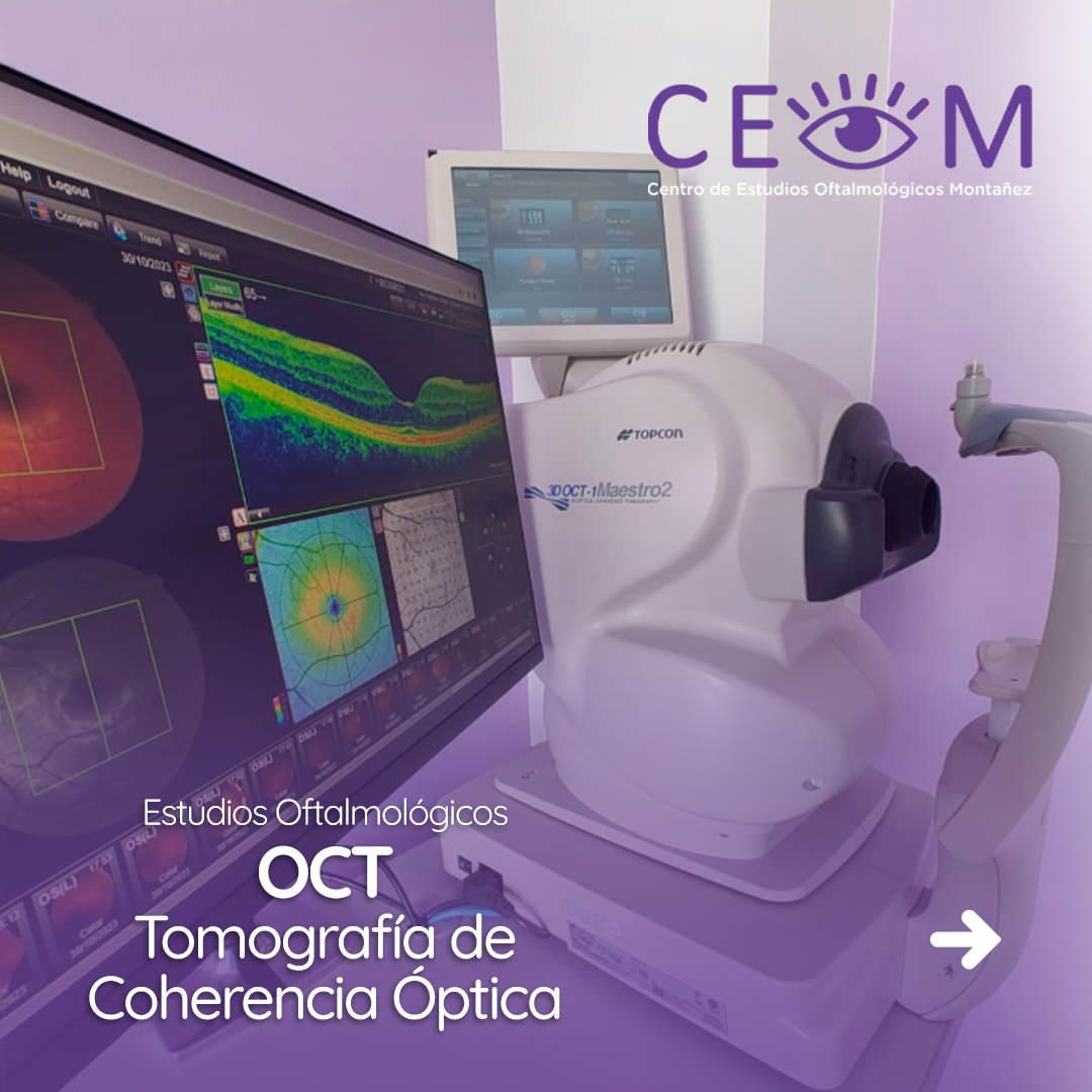 s1_oct_feed_01 s1_oct_feed_01