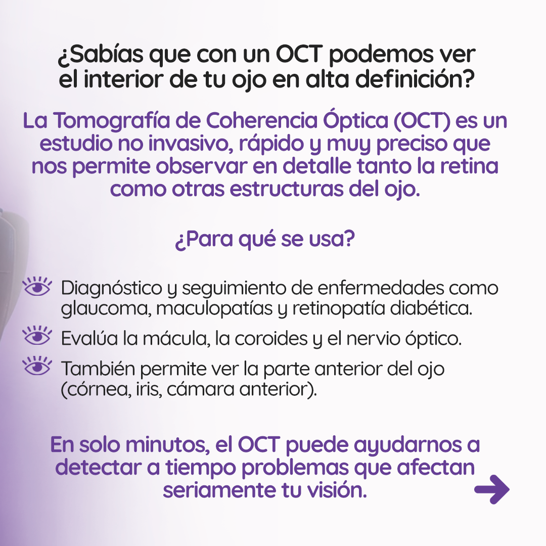 s1_oct_feed_02 s1_oct_feed_02