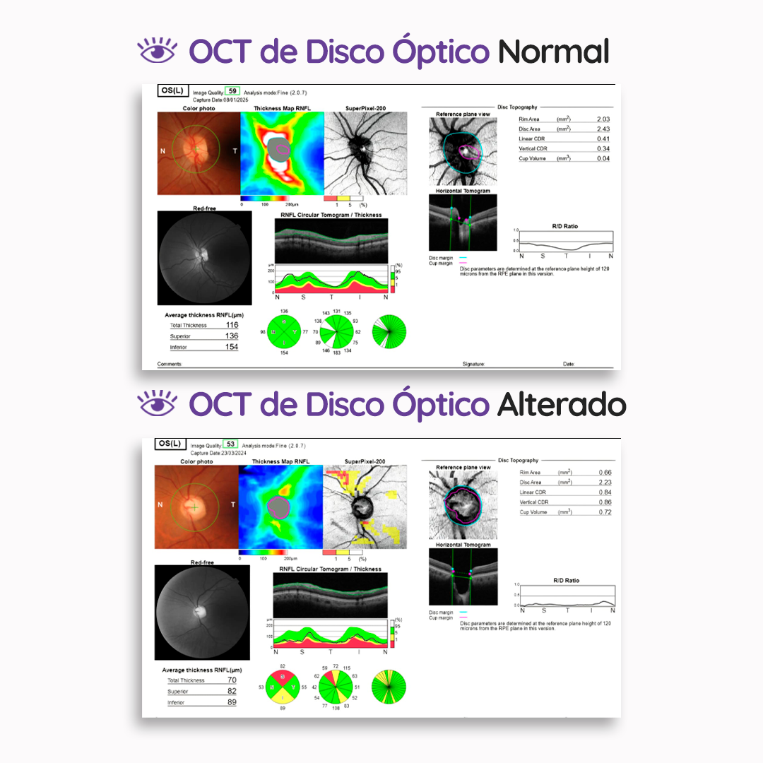 s1_oct_feed_03 s1_oct_feed_03