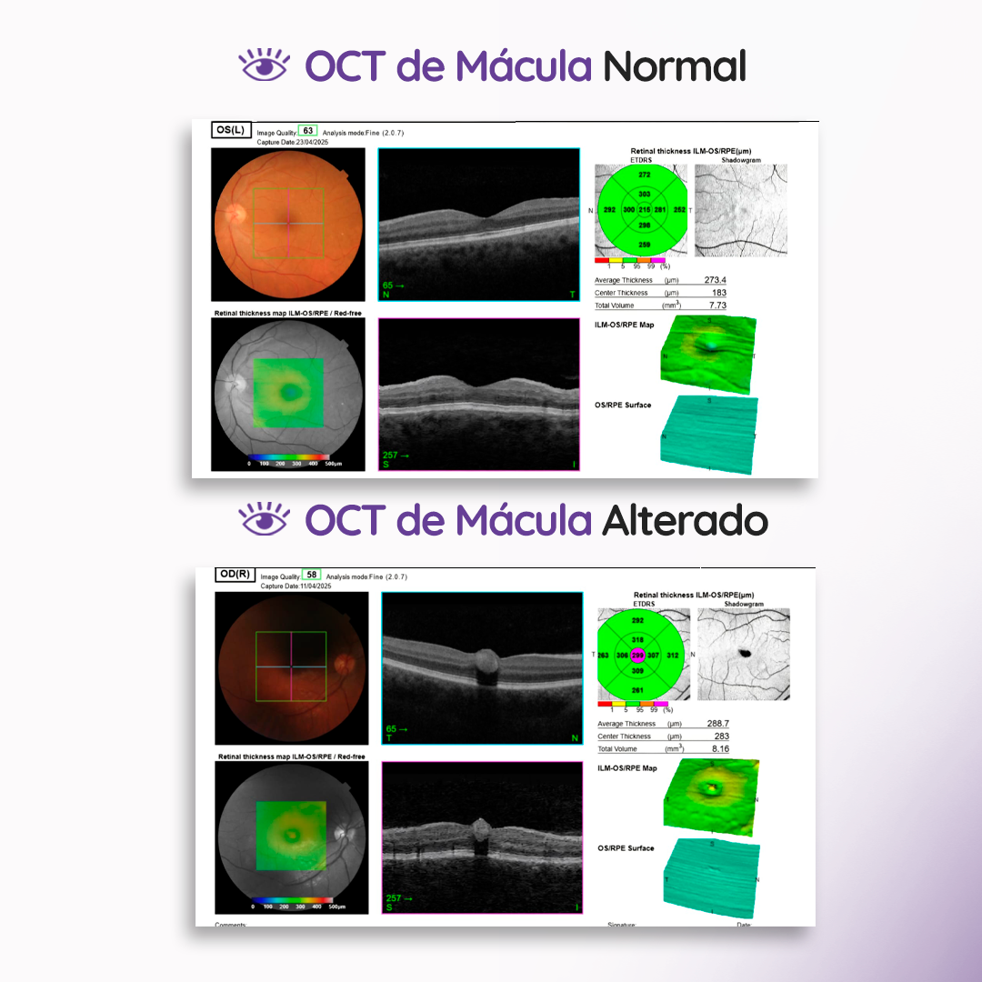 s1_oct_feed_04 s1_oct_feed_04