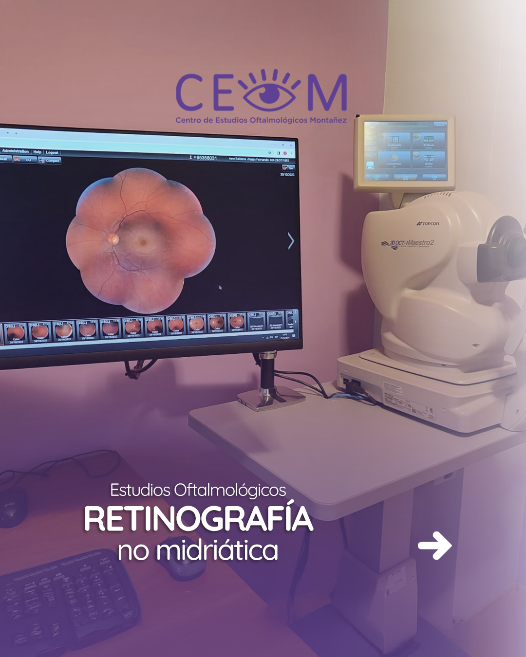 s2_retinografia_feed_1080x1350_01