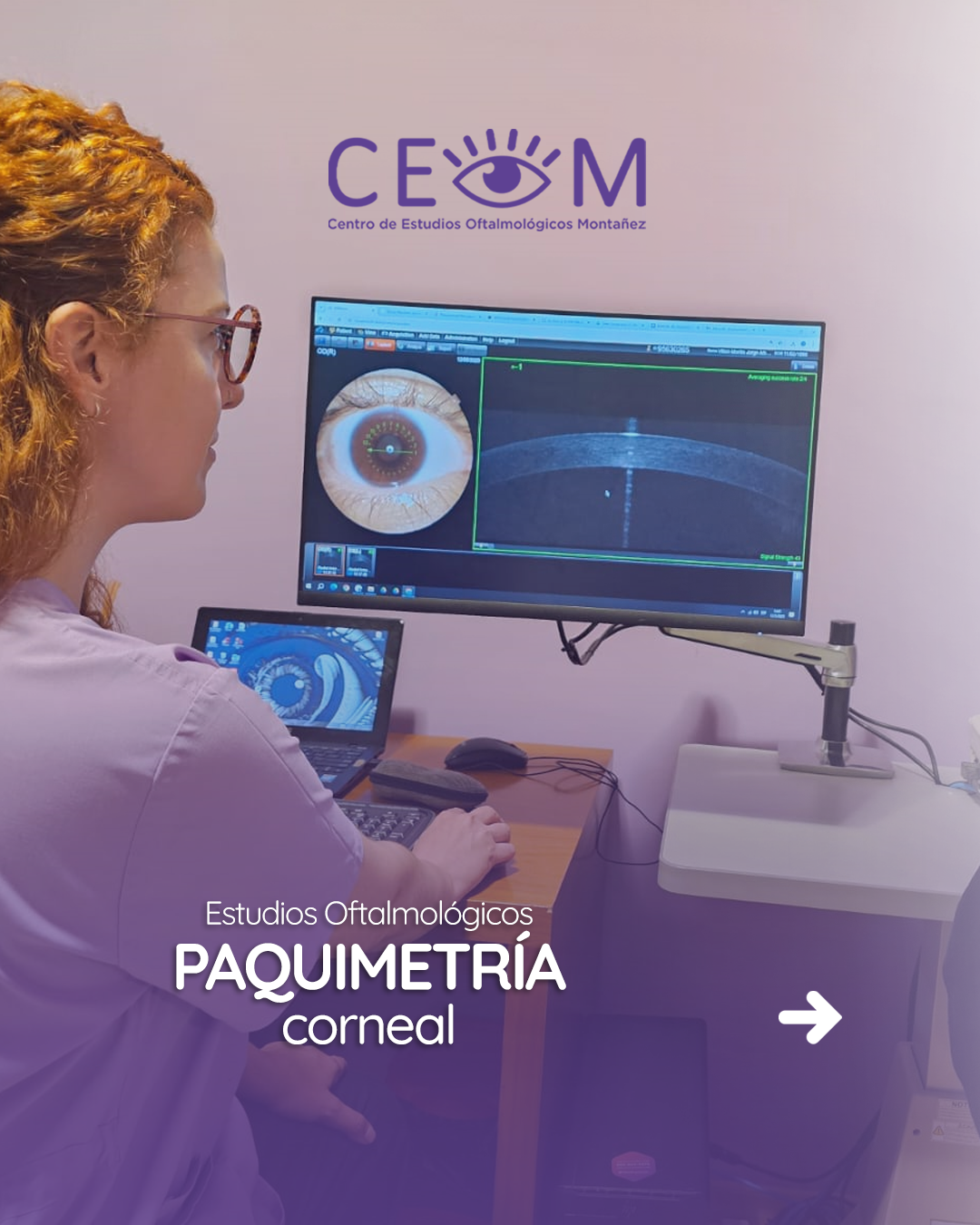 s3_paquimetria_feed_1080x1350_01