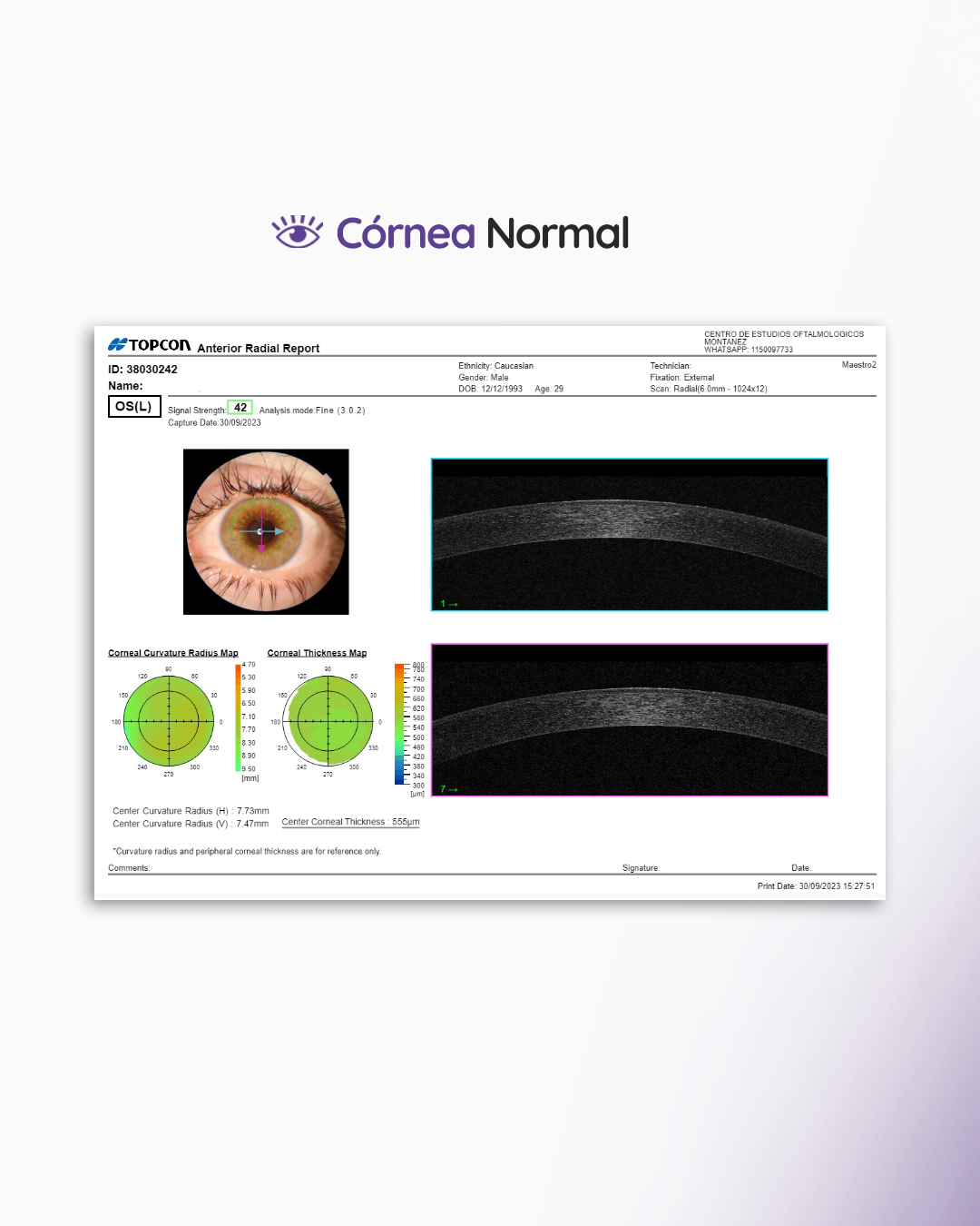 s3_paquimetria_feed_1080x1350_04