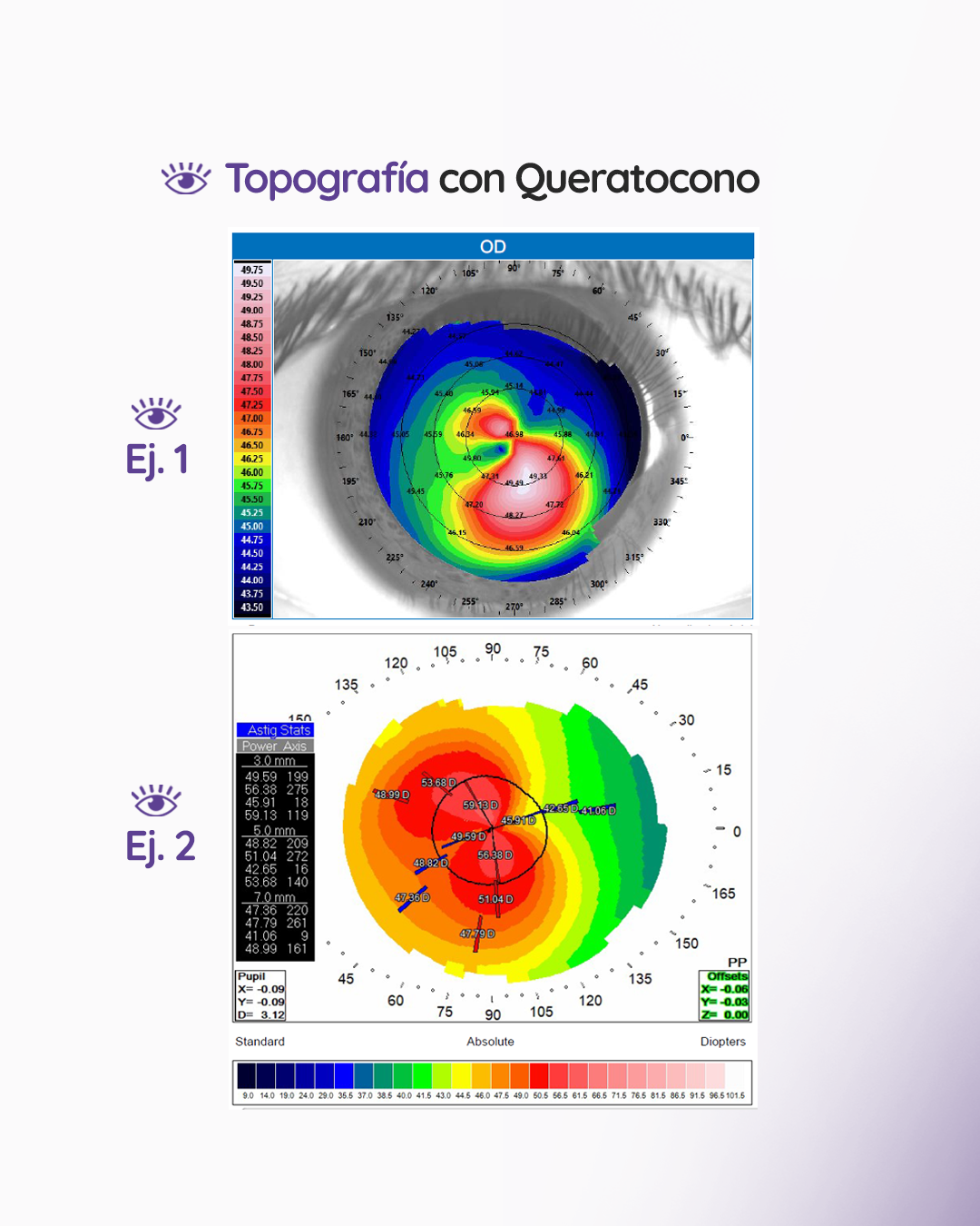 s4_topografia_feed_1080x1350_04