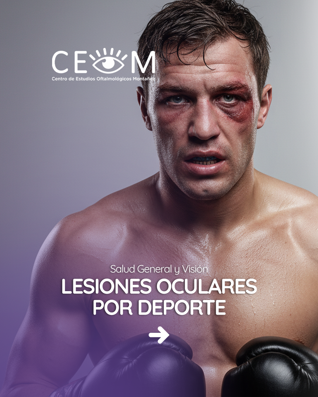 s1_lesionesocularesdeporte_feed_1080x1350px_01 s1_lesionesocularesdeporte_feed_1080x1350px_01