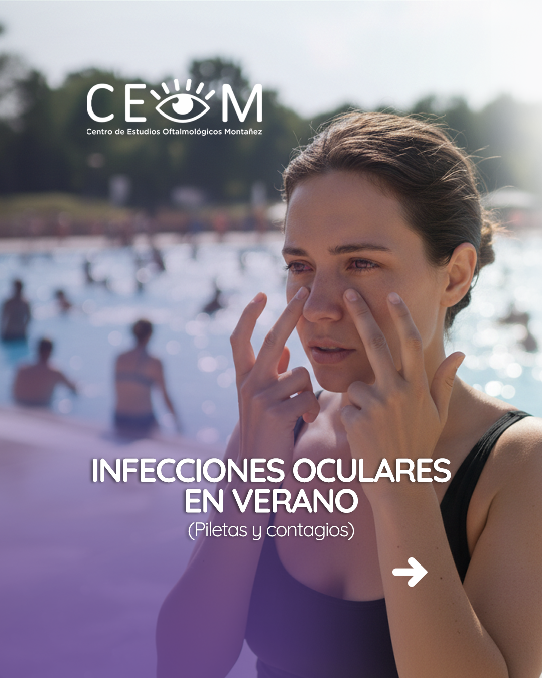 s2_infeccionesoculares_feed_1080x1350_01