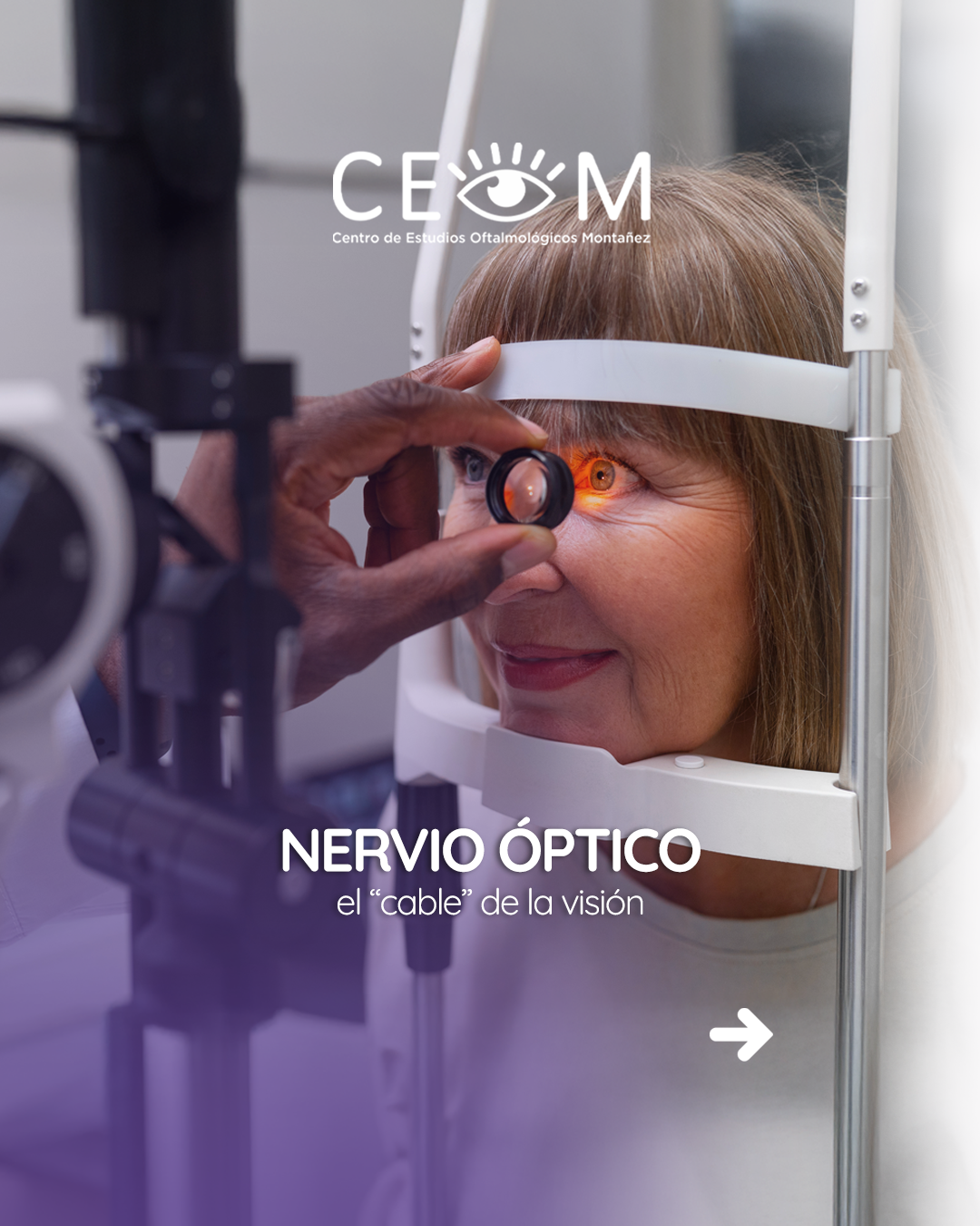 s1_nerviooptico_feed_1080x1350_01