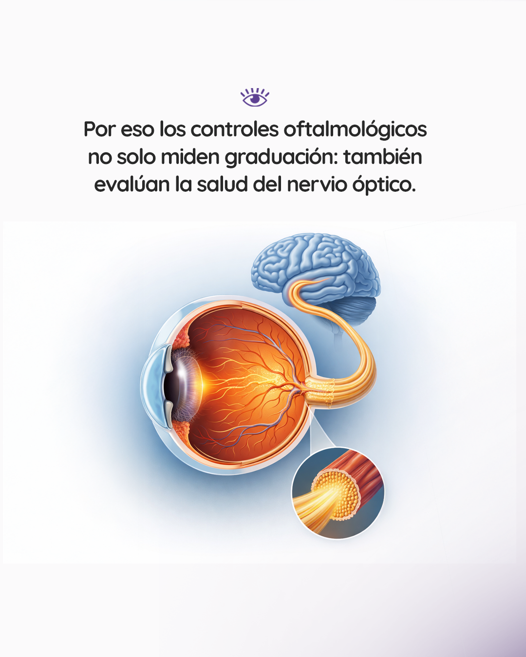 s1_nerviooptico_feed_1080x1350_03