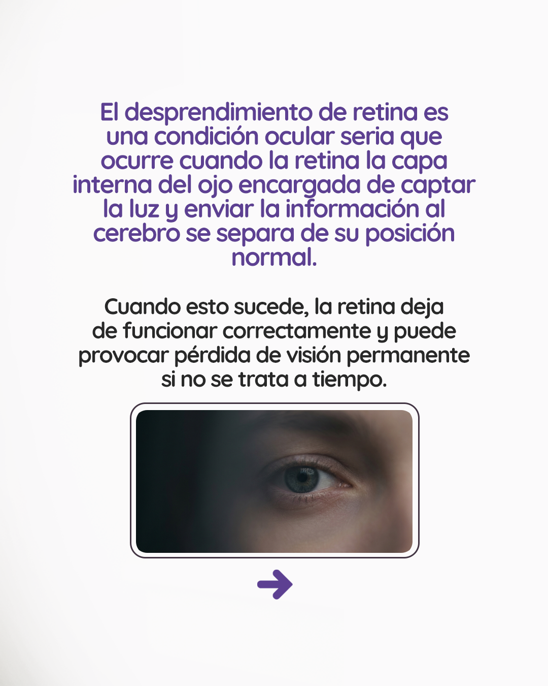 s1_desprendimientoretina_feed_1080x1350_02