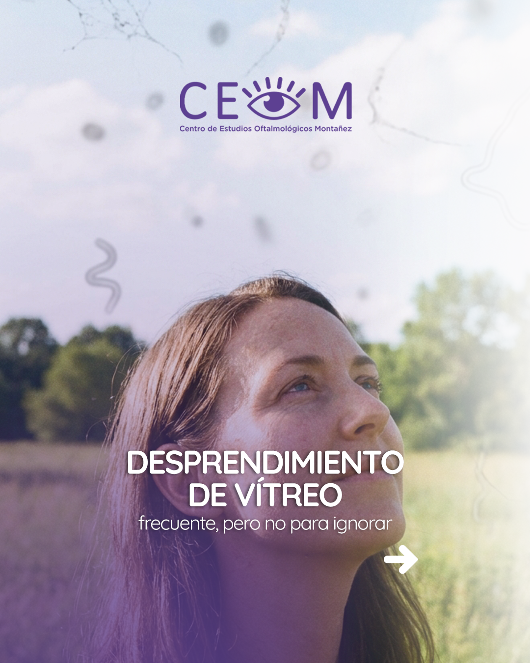 s4_desprendimientovitreo_feed_1080x1350_01