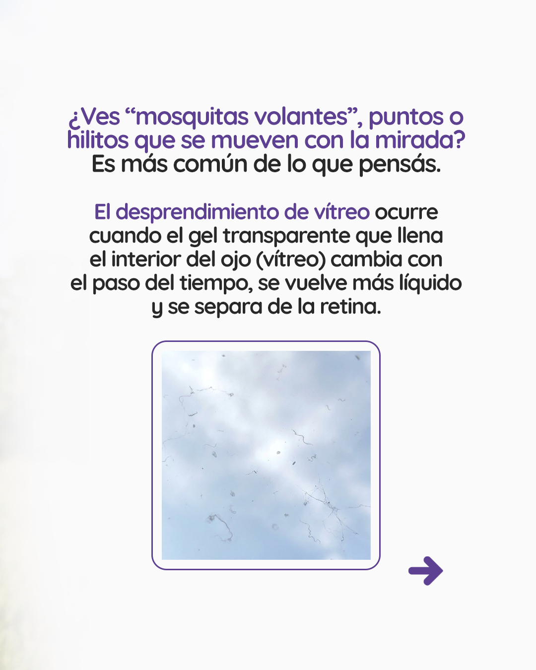 s4_desprendimientovitreo_feed_1080x1350_02