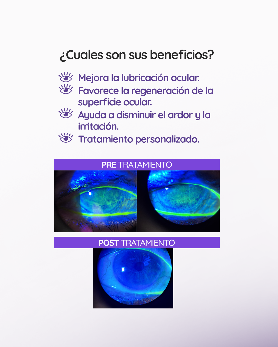 s2_sueroautologo_feed_1080x1350_03