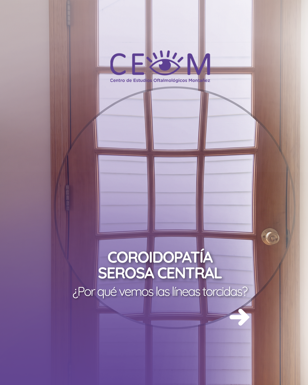 s1_coroidopatiaserosacentral_feed_1080x1350_01