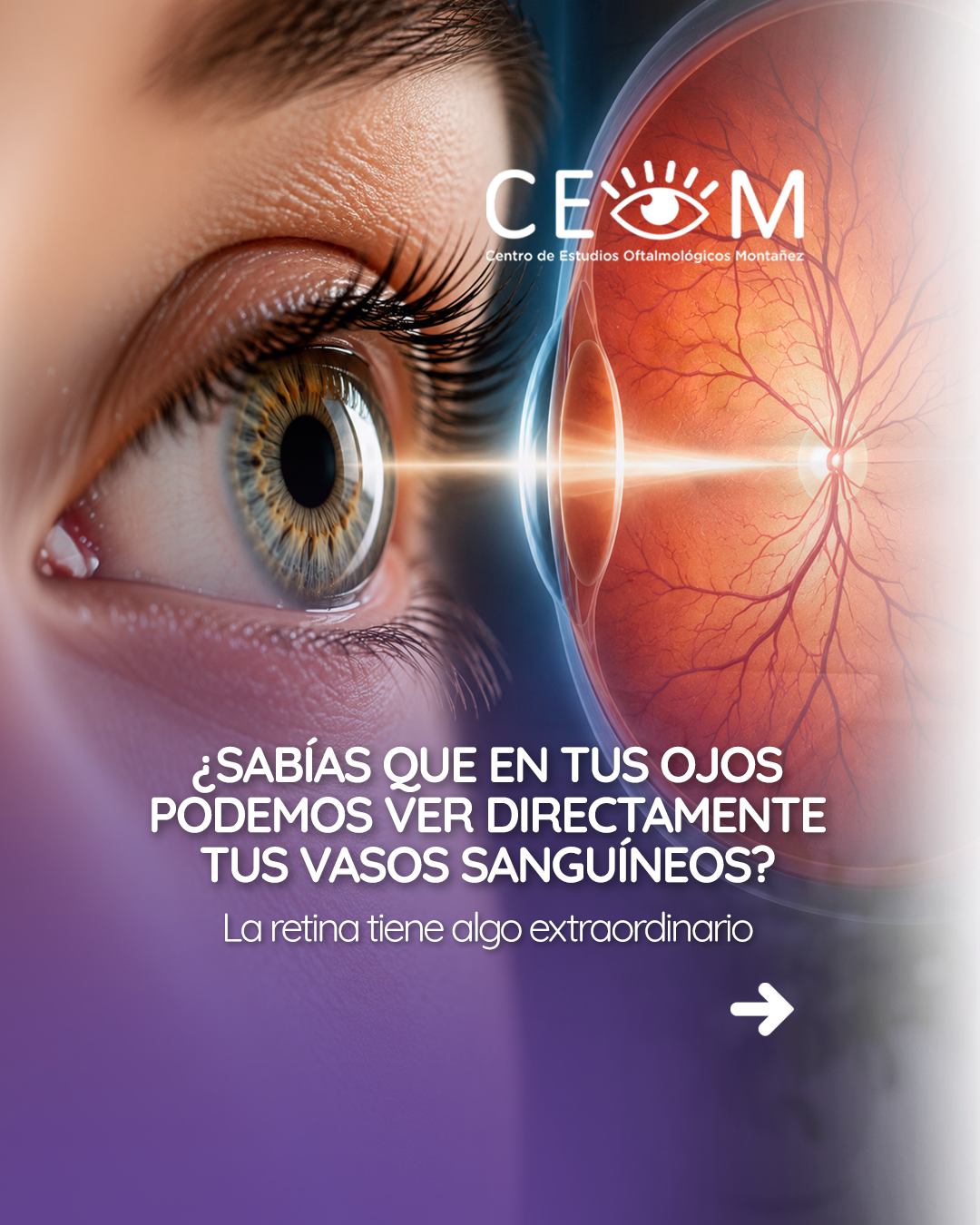 s3_retinavasossanguineos_feed_1080x1350_01