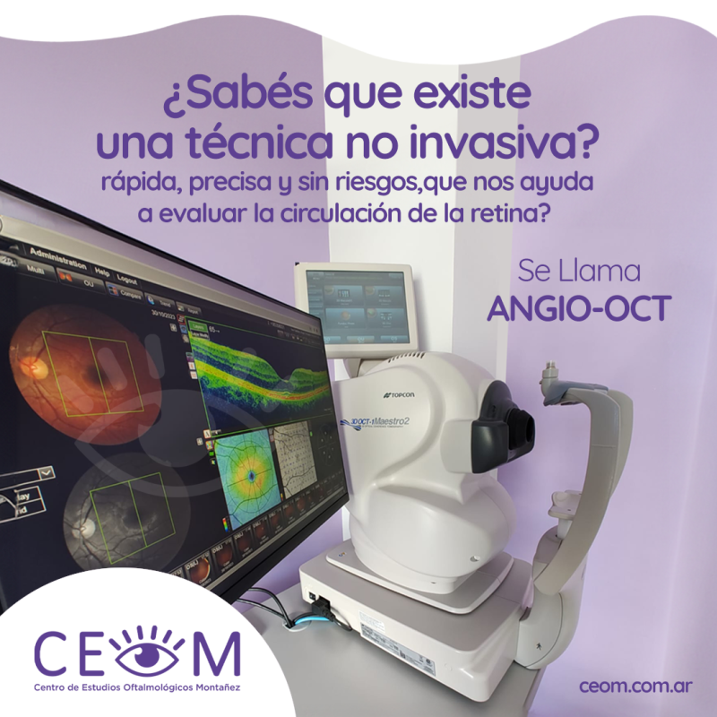 placa_angio_oct placa_angio_oct