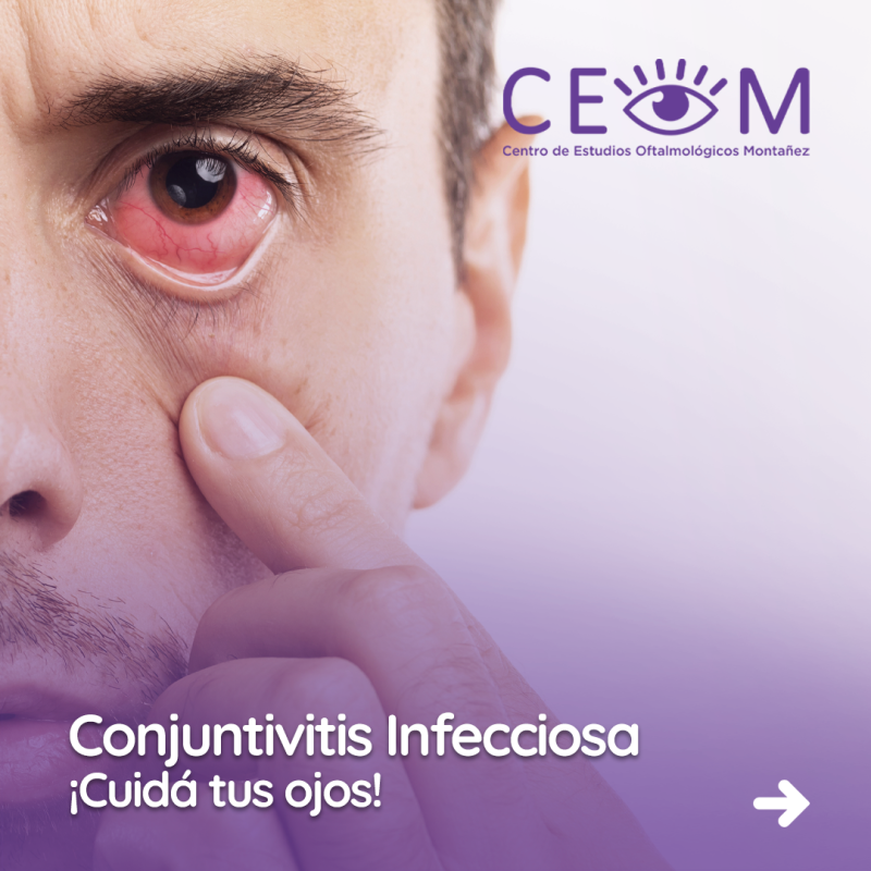 s1_conjuntivitis_feed_01 s1_conjuntivitis_feed_01
