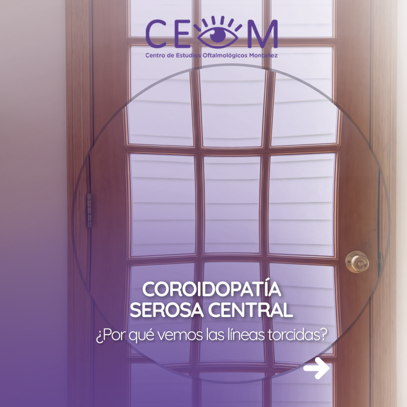 s1_coroidopatiaserosacentral_feed_1080x1350_01