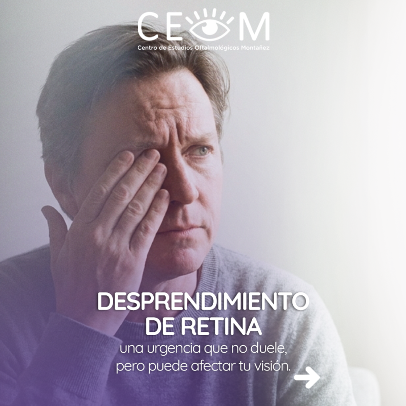 s1_desprendimientoretina_feed_1080x1350_01