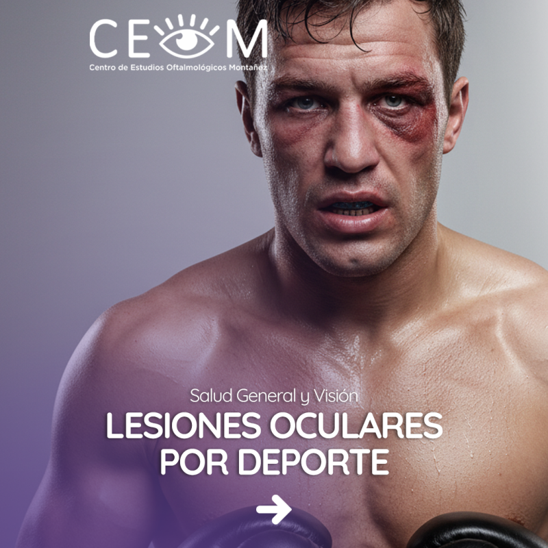 s1_lesionesocularesdeporte_feed_1080x1350px_01 s1_lesionesocularesdeporte_feed_1080x1350px_01