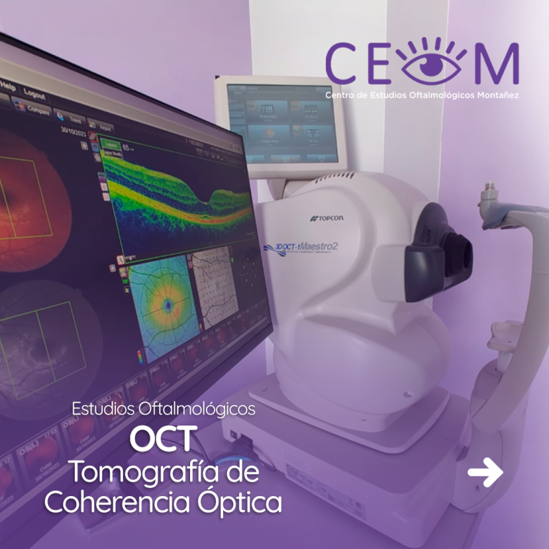 s1_oct_feed_01 s1_oct_feed_01