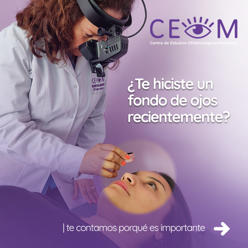 s2_fondodeojos_feed_01 s2_fondodeojos_feed_01