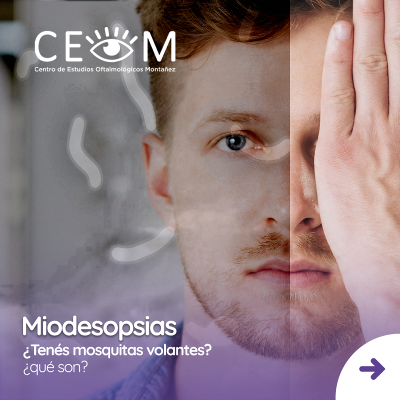 s2_miodesopsias_feed_01 s2_miodesopsias_feed_01