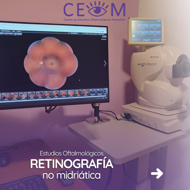 s2_retinografia_feed_1080x1350_01 s2_retinografia_feed_1080x1350_01