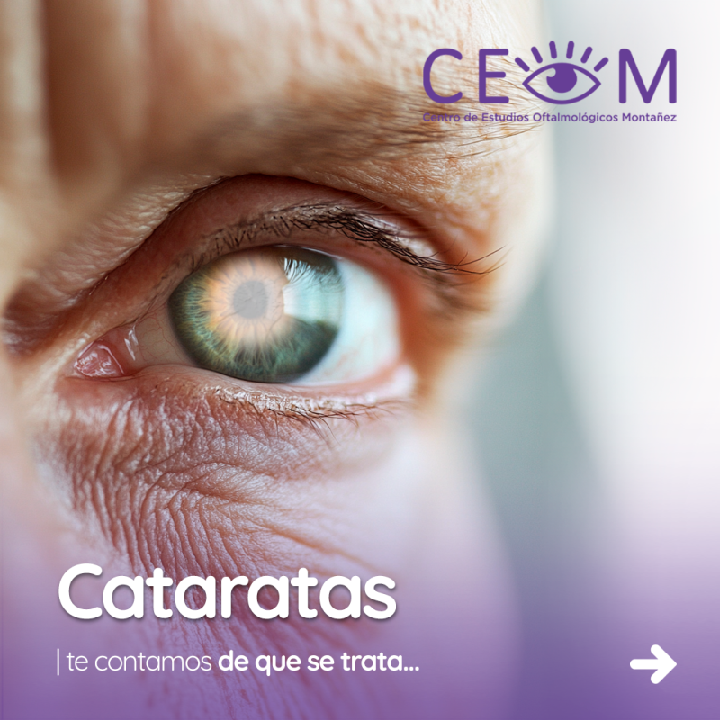 s3_cataratas_feed_01 s3_cataratas_feed_01