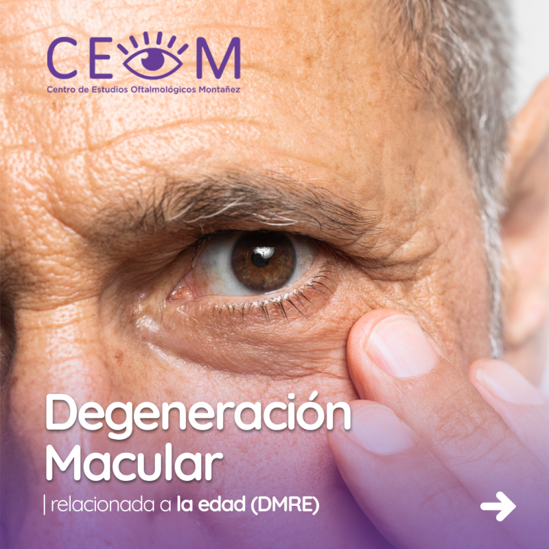 s3_degeneracionmacular_feed_01 s3_degeneracionmacular_feed_01
