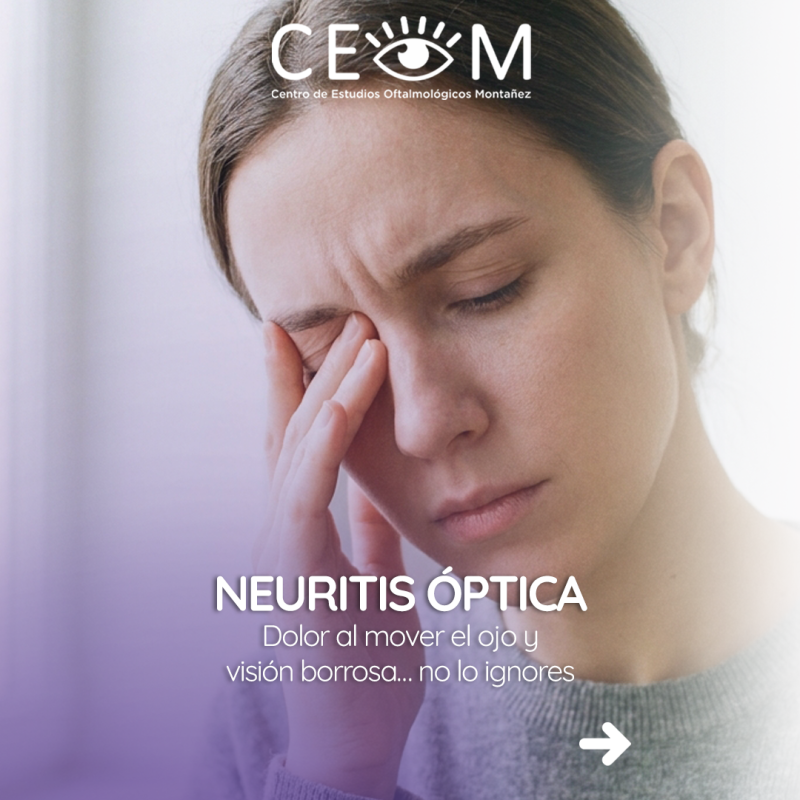s3_neuritisoptica_feed_1080x1350_01