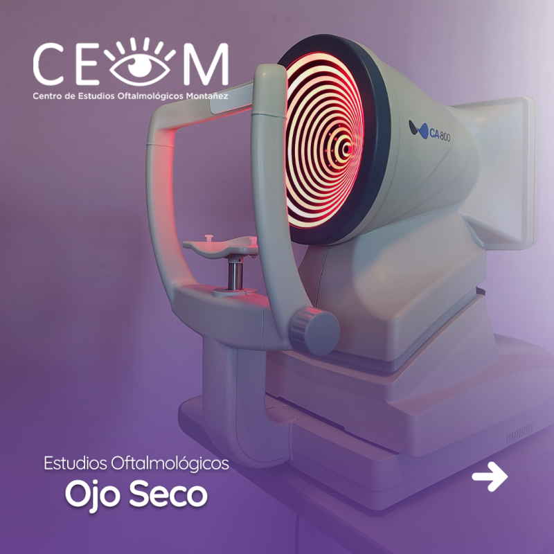 s3_ojoseco_feed_01 s3_ojoseco_feed_01