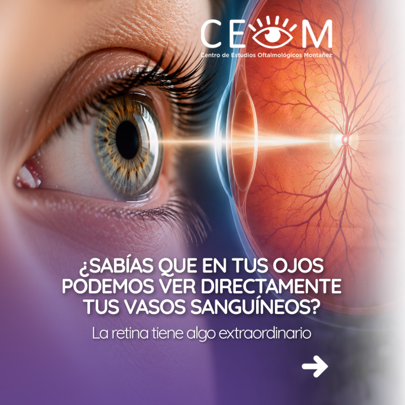 s3_retinavasossanguineos_feed_1080x1350_01