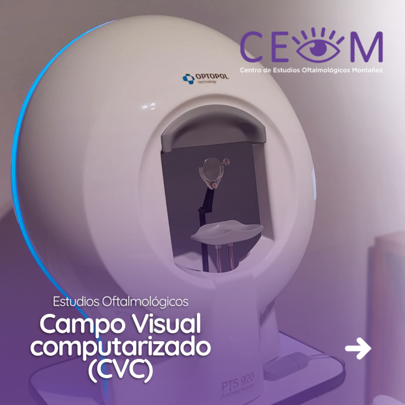 s4_campovisualcomputarizadocvc_feed_01 s4_campovisualcomputarizadocvc_feed_01