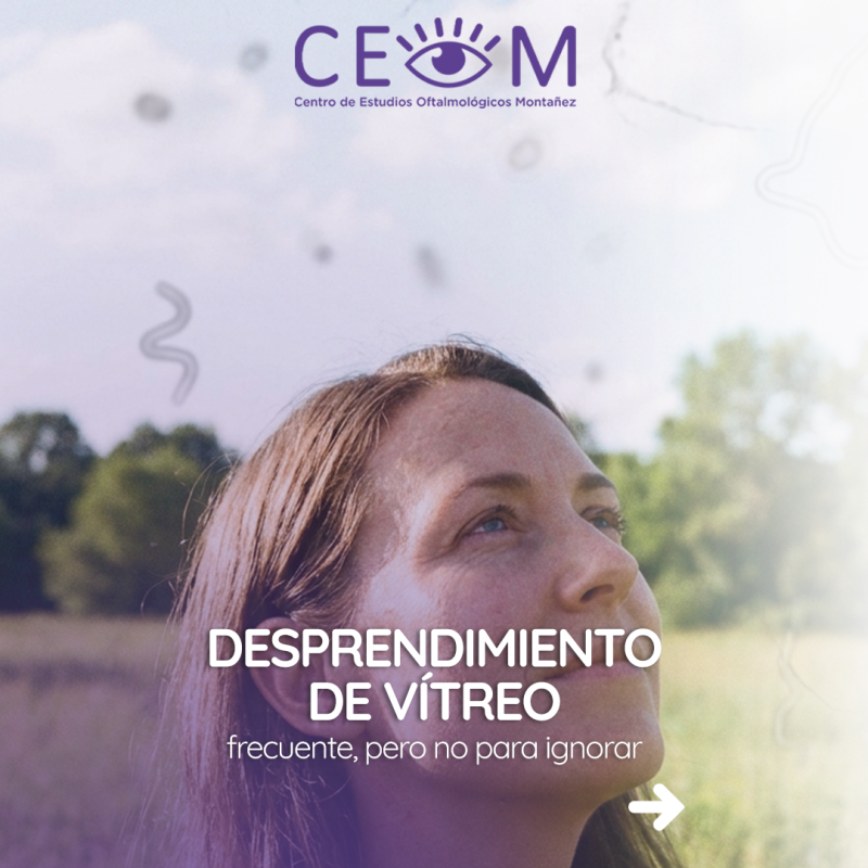s4_desprendimientovitreo_feed_1080x1350_01