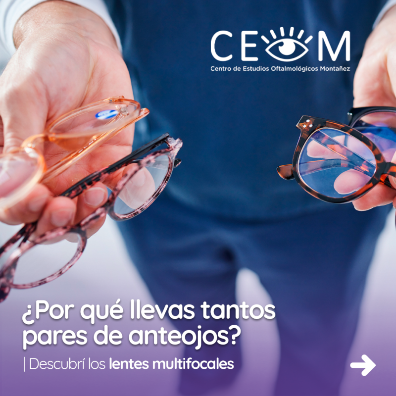 s4_lentes_feed_01 s4_lentes_feed_01
